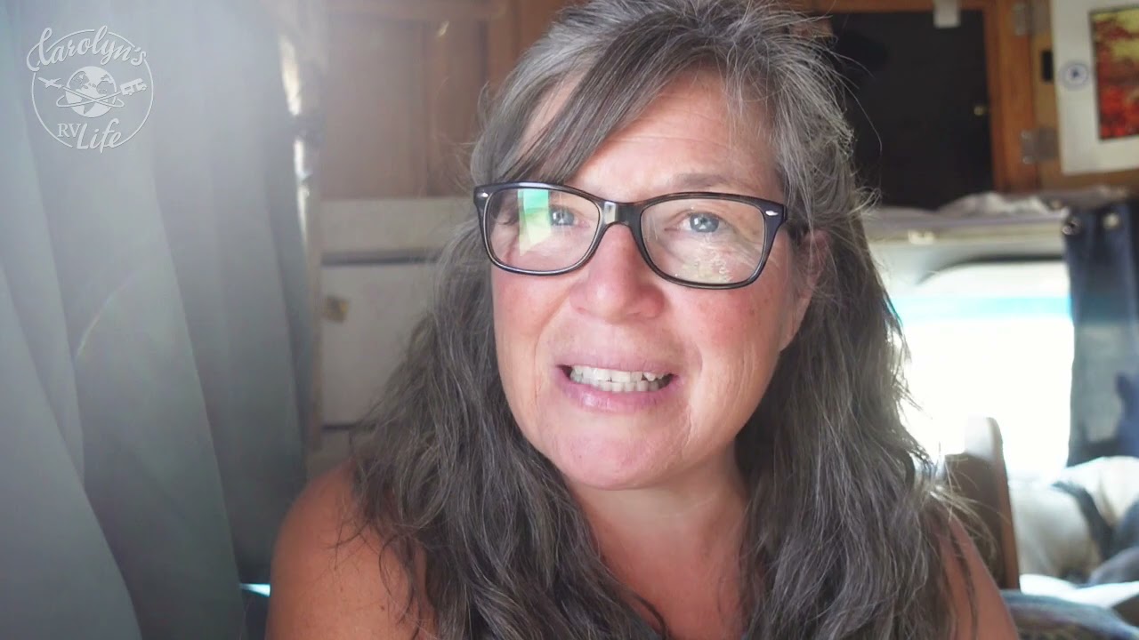 RV Repair  Update and my Valley Fever Test Results are In