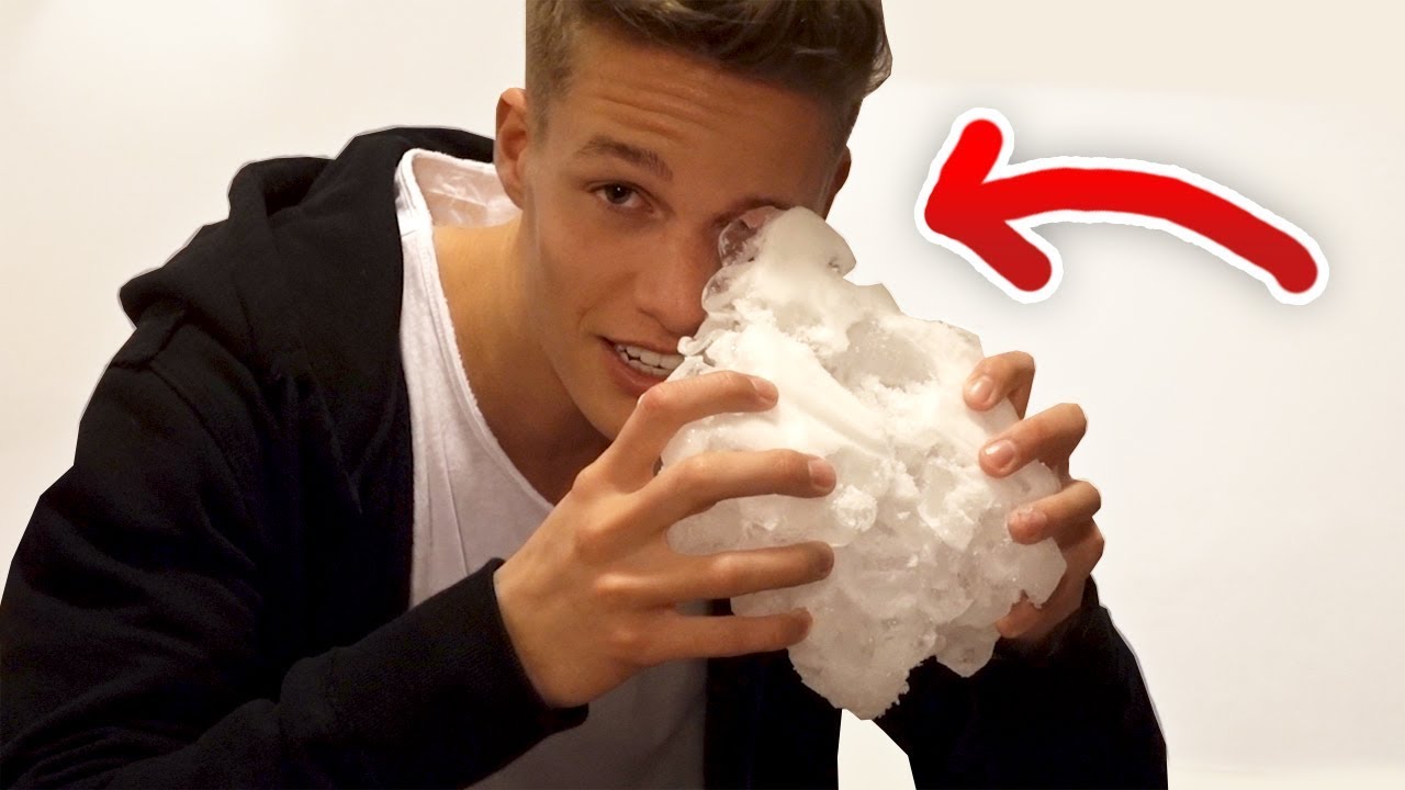 Ich habe mich verletzt... 😱 (Vlog)