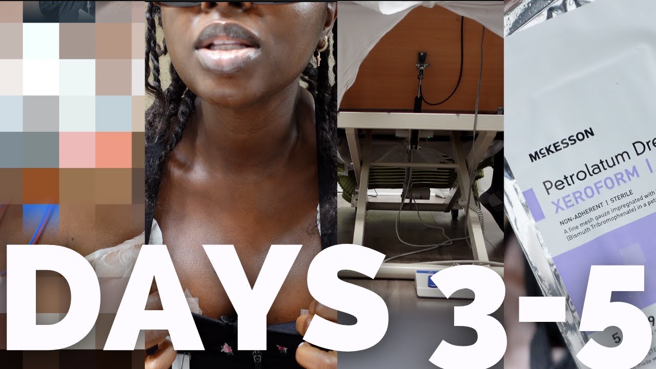 (RAW) GOD HELP ME! forgot ANTIBIOTICS, DIZZY, Body Odor? Mall, Belly Button Gauze |Ep. 4 |menaadubea