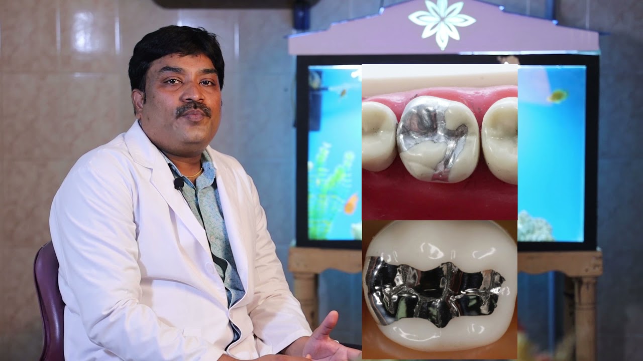 சொத்தை பல் நிரப்பும் வழிகள்?| Different Types of Dental Filling| Dr.V.Madhusoodhanan explains