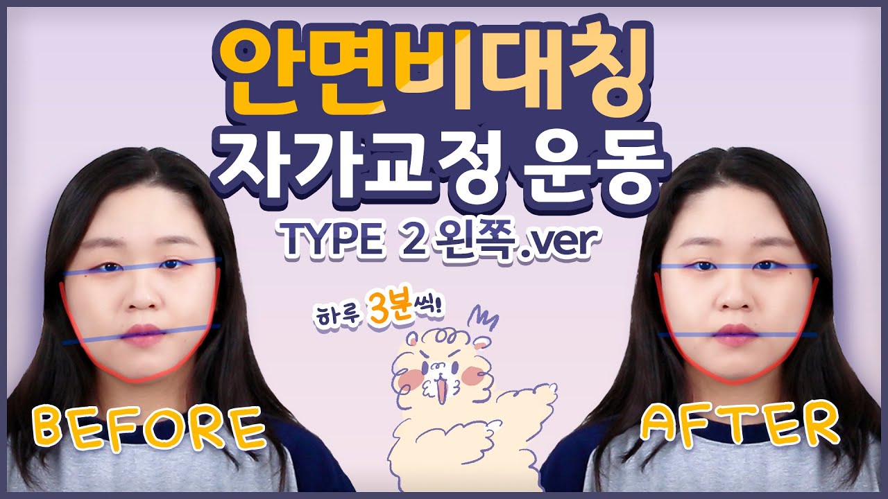 [왼쪽] 안면비대칭 type 2 자가교정운동 | 정파카