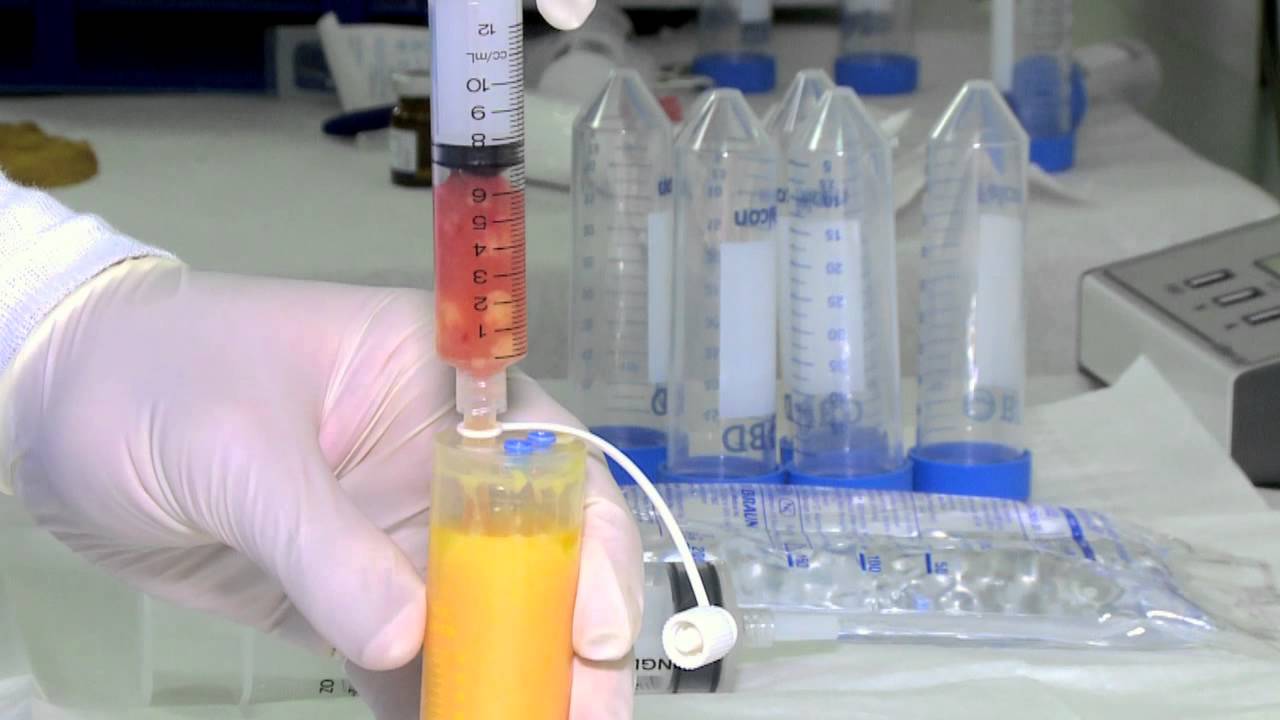 U.S. Stem Cell Clinic: How is Stem Cell Therapy Performed?