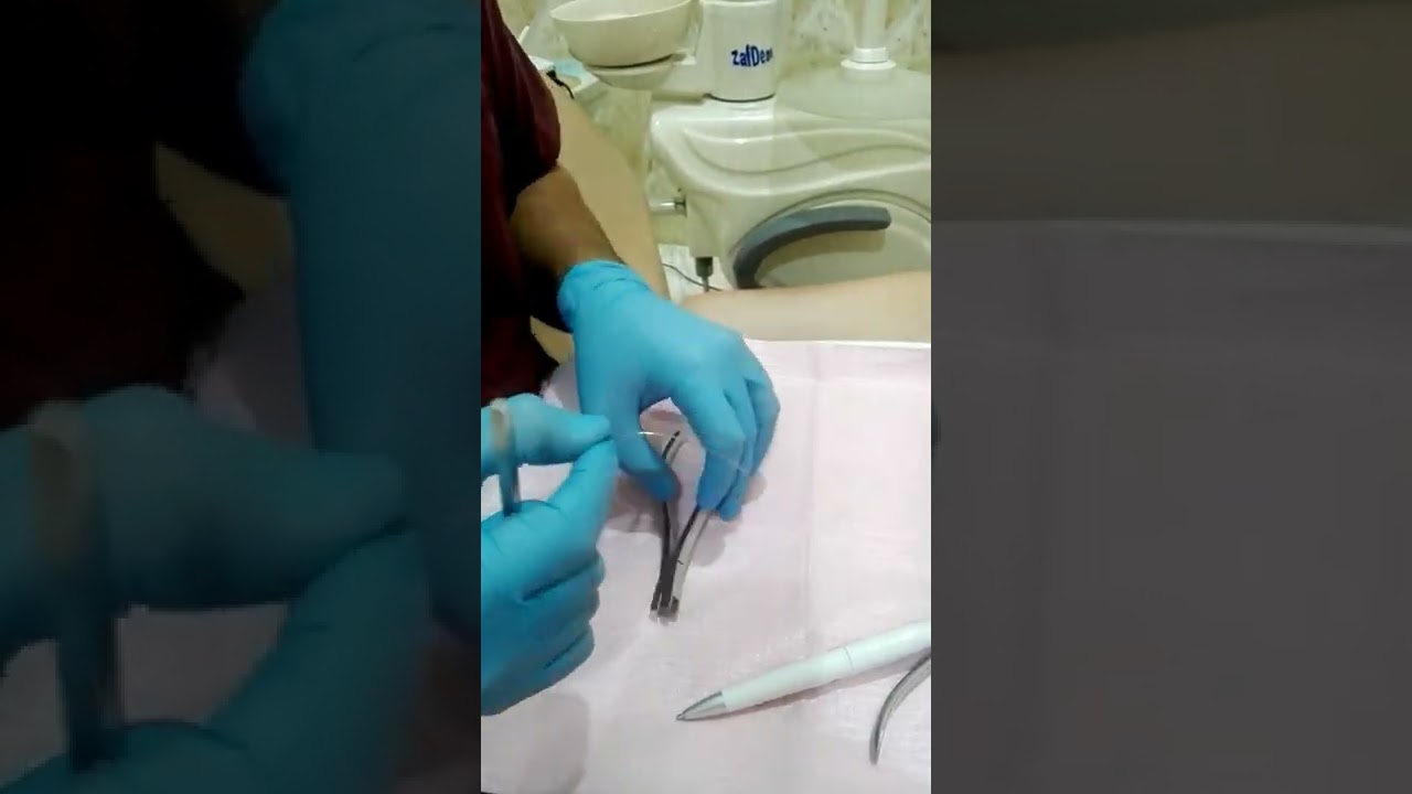 Individual tooth torque ,Torque plier ,Torque , 3 rd Order bend .