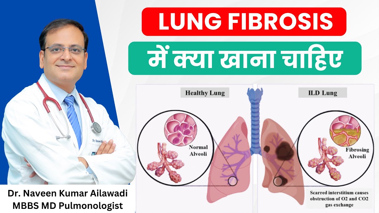 Lung Fibrosis (ILD) में क्या खाना चाहिए | Superfoods for Lung Fibrosis | Dr Naveen Ailawadi #ild