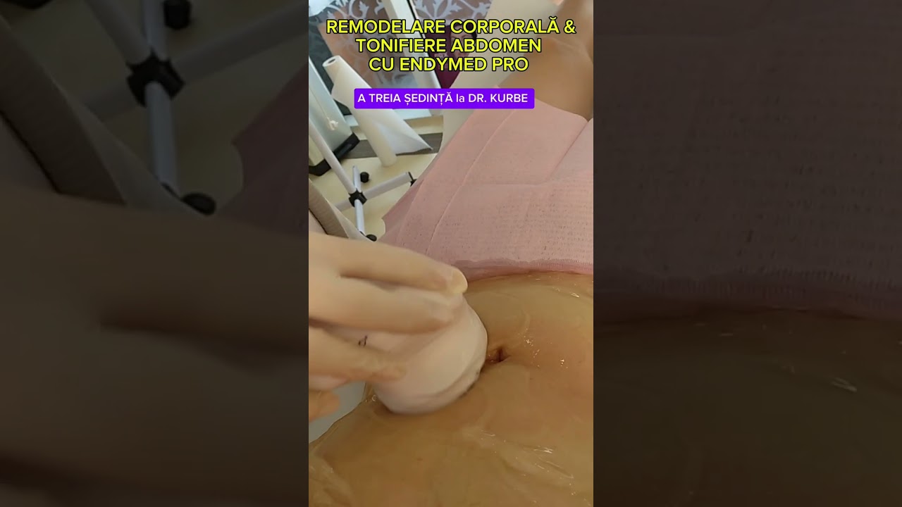 Dr. Kurbe | A TREIA ȘEDINȚĂ