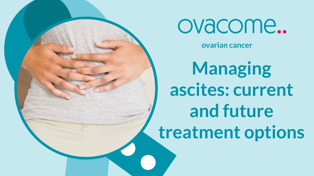 Managing ascites: current and future treatment options