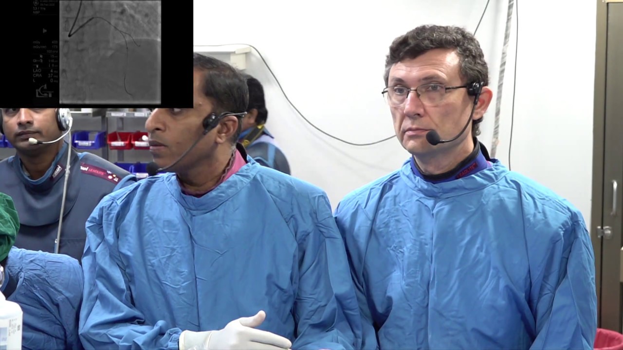Complex LAD diagonal bifurcation stenosis by Dr. Mauricio Cohen (TRICO 2020 Live Case)
