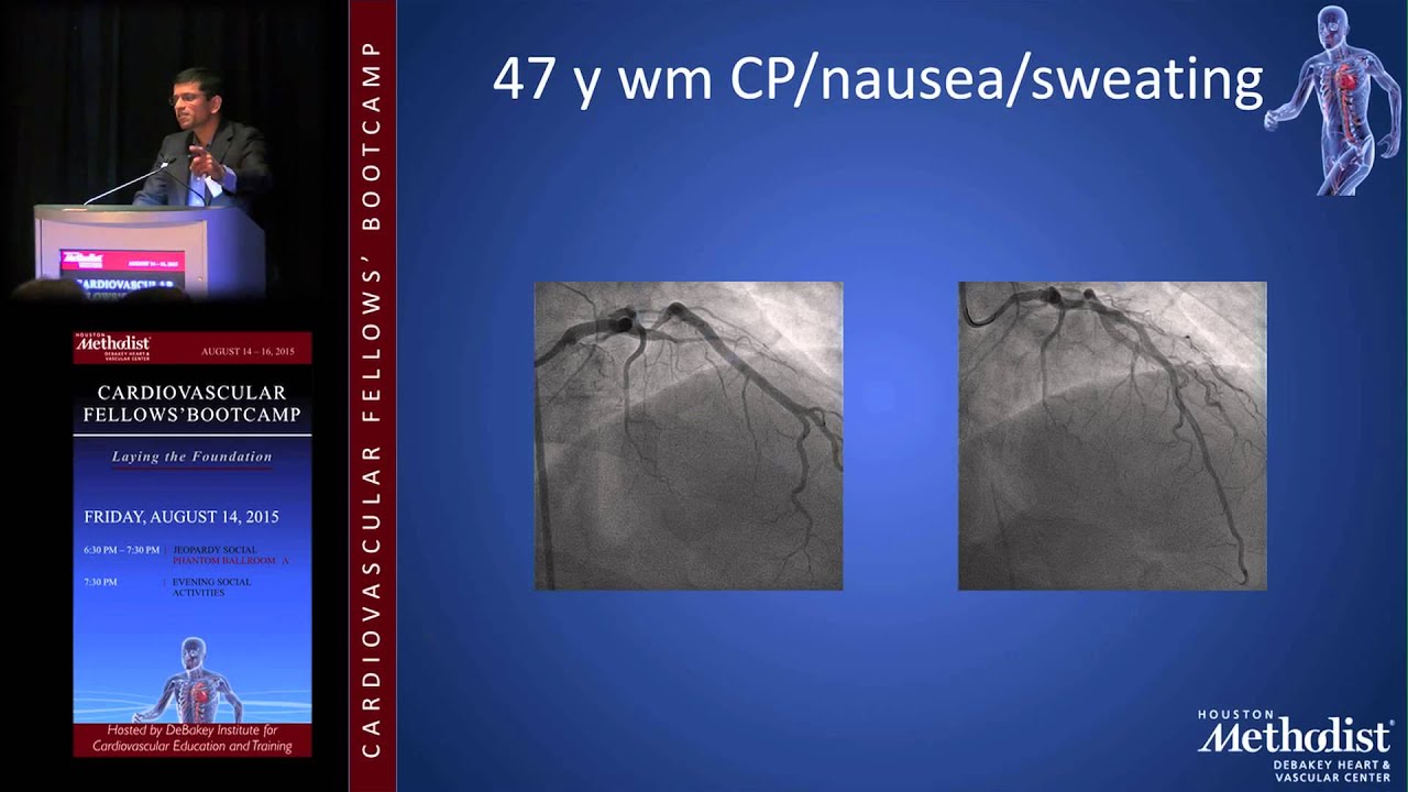 STEMI (Syed A. Gilani, MD)