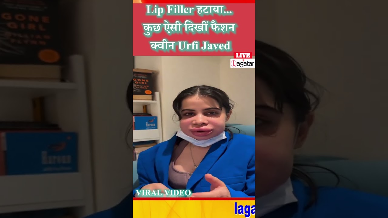Lip Filler हटाया... कुछ ऐसी दिखीं फैशन क्वीन Urfi Javed !/ live lagatar news