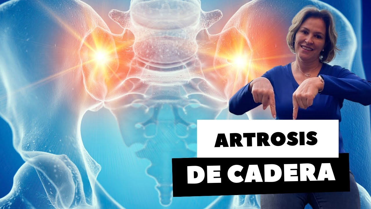 ARTROSIS DE CADERA PARTE 1