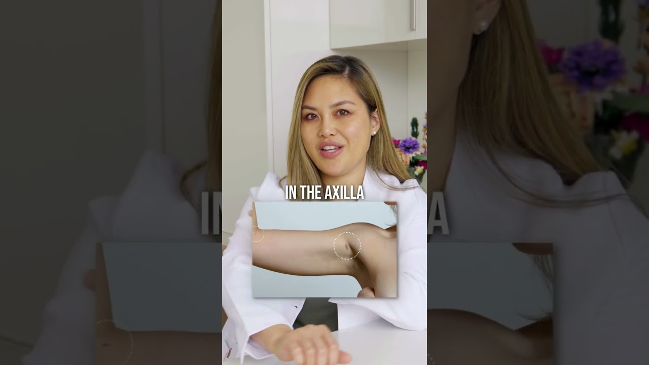Arm Lipo Vs. Arm Lift: What&rsquo;s The Difference? | Dr. Wendy Wong.