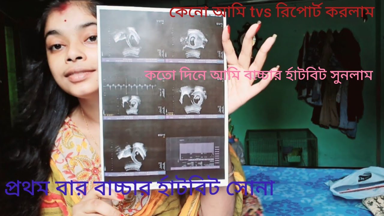 pregnancy TVS আর USG report আমি কতো মাসে করেছি।।