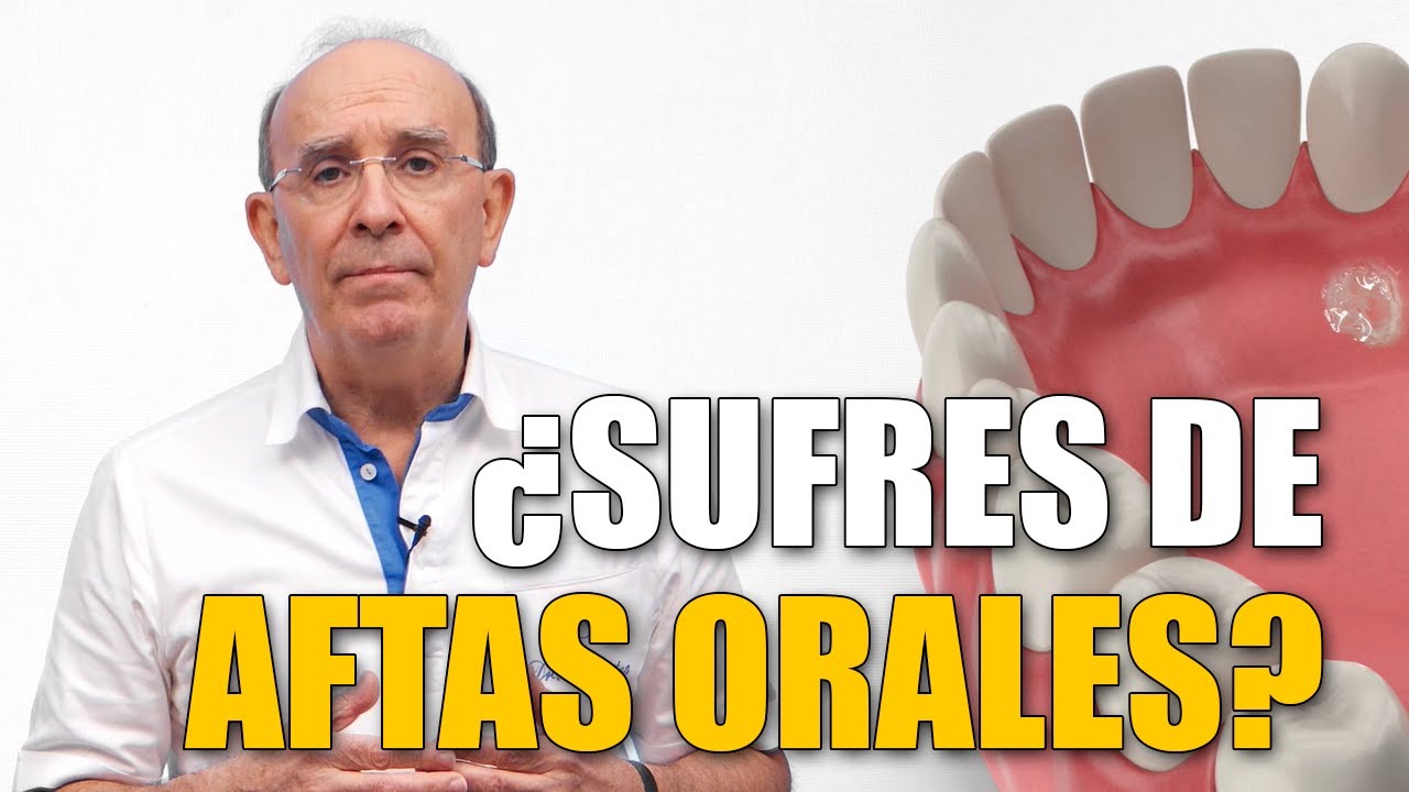 Aftas o llagas bucales: por qu&eacute; salen y c&oacute;mo se curan