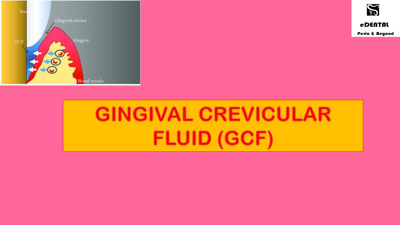 GINGIVAL CREVICULAR FLUID (GCF)