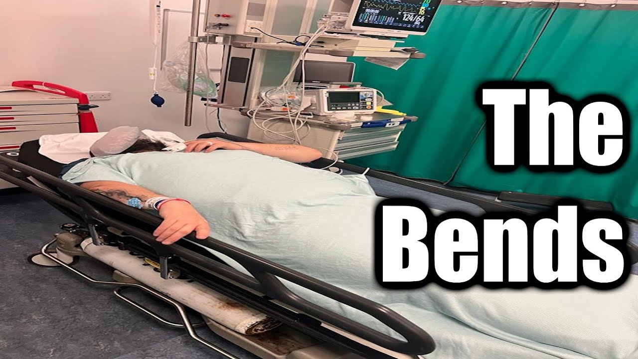 I Got Bent - Vestibular Decompression Sickness (DCI) is Seriously NOT FUN!