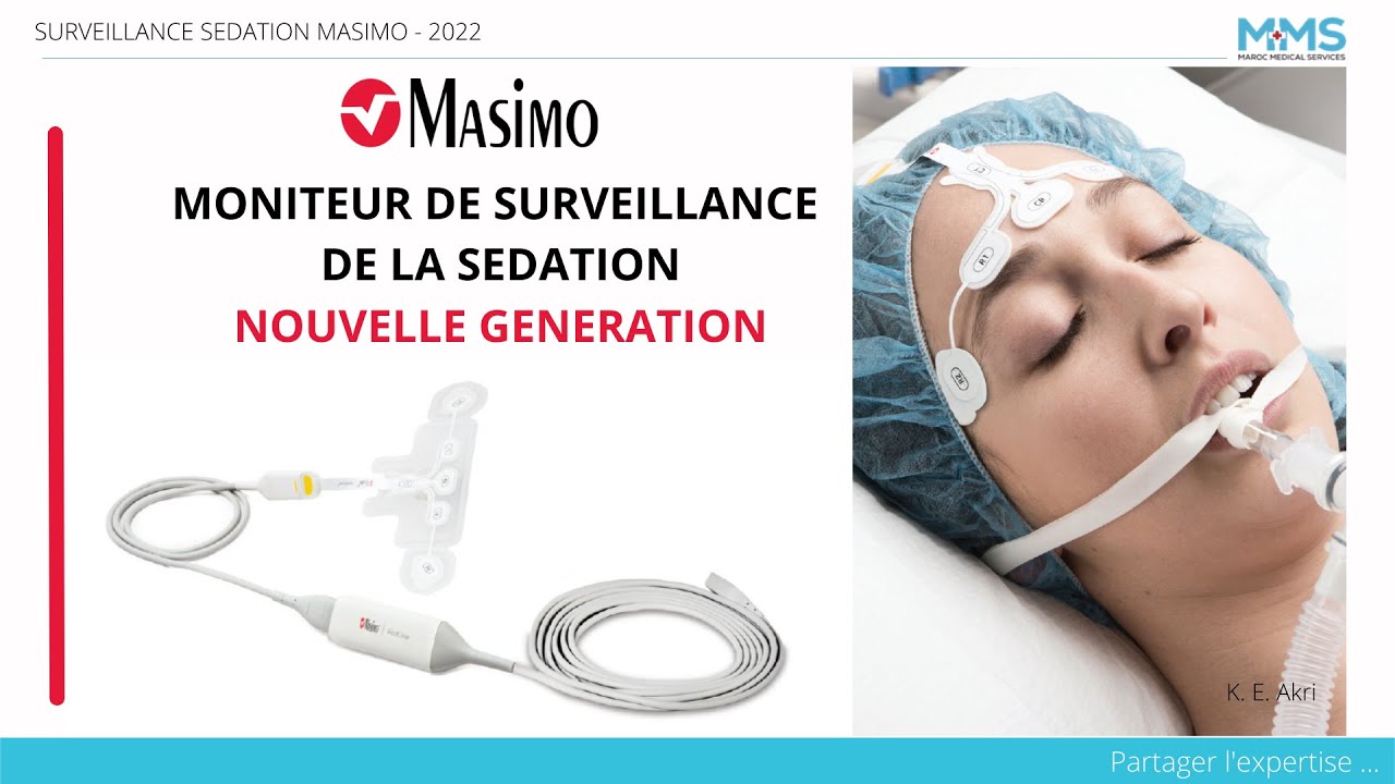 Moniteur de Surveillance de la Sédation – Nouvelle Génération