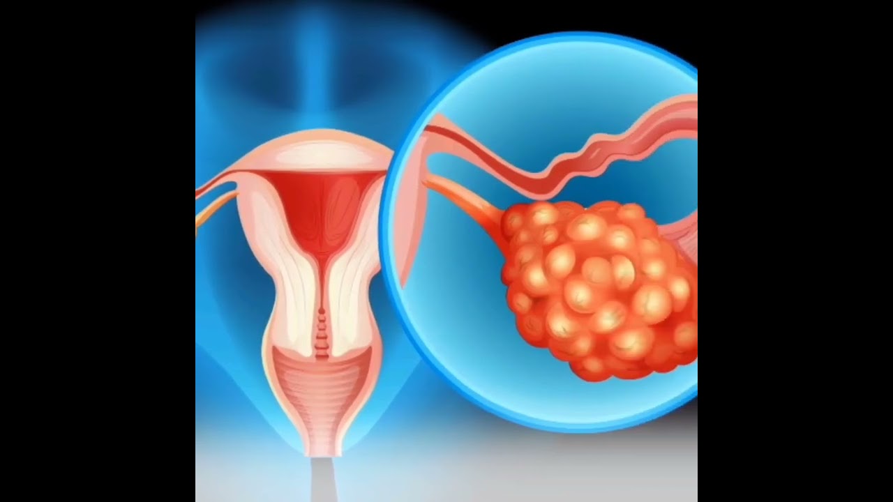 বন্ধ্যাত্ব মানেই শেষ নয়—আছে সমাধান(Infertility is not the end—there is a solution)