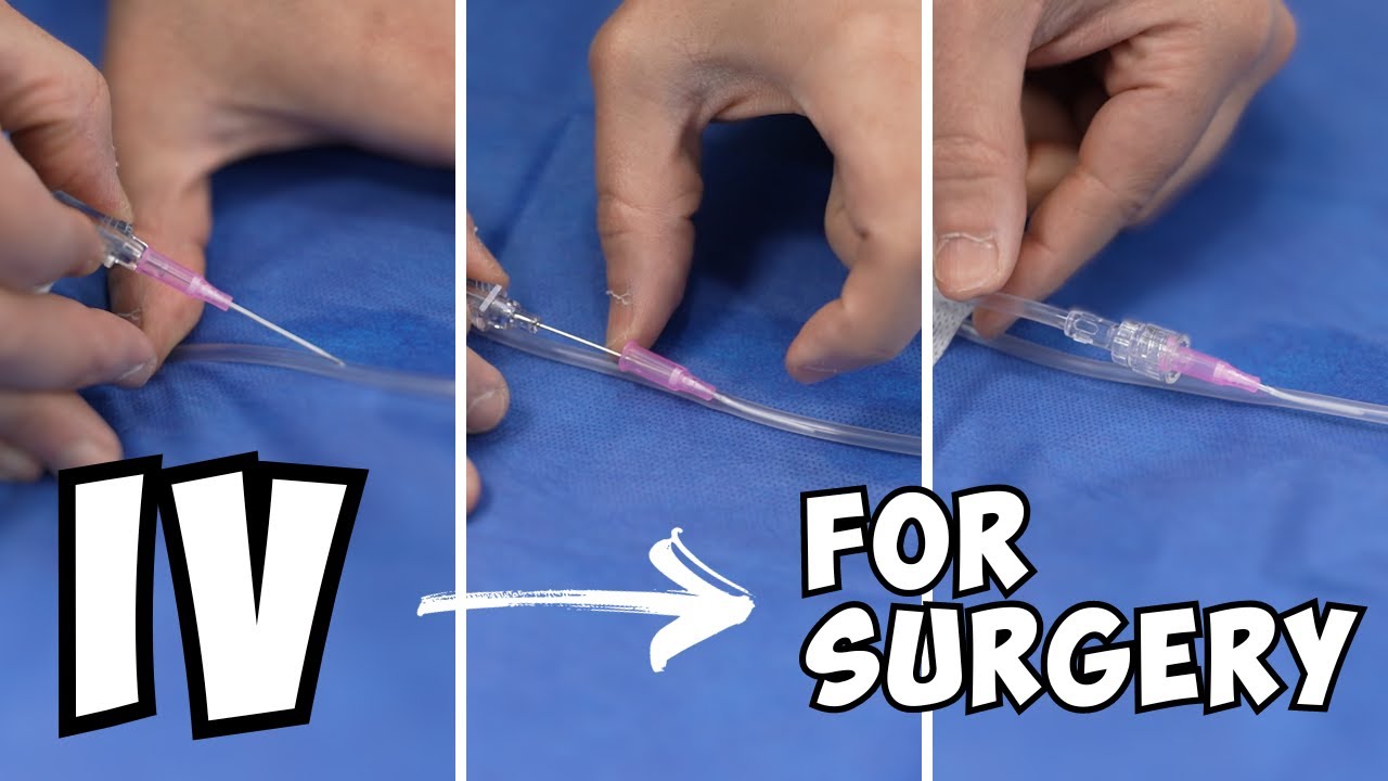 IV for Surgery: Why do you need it? How to start an IV.