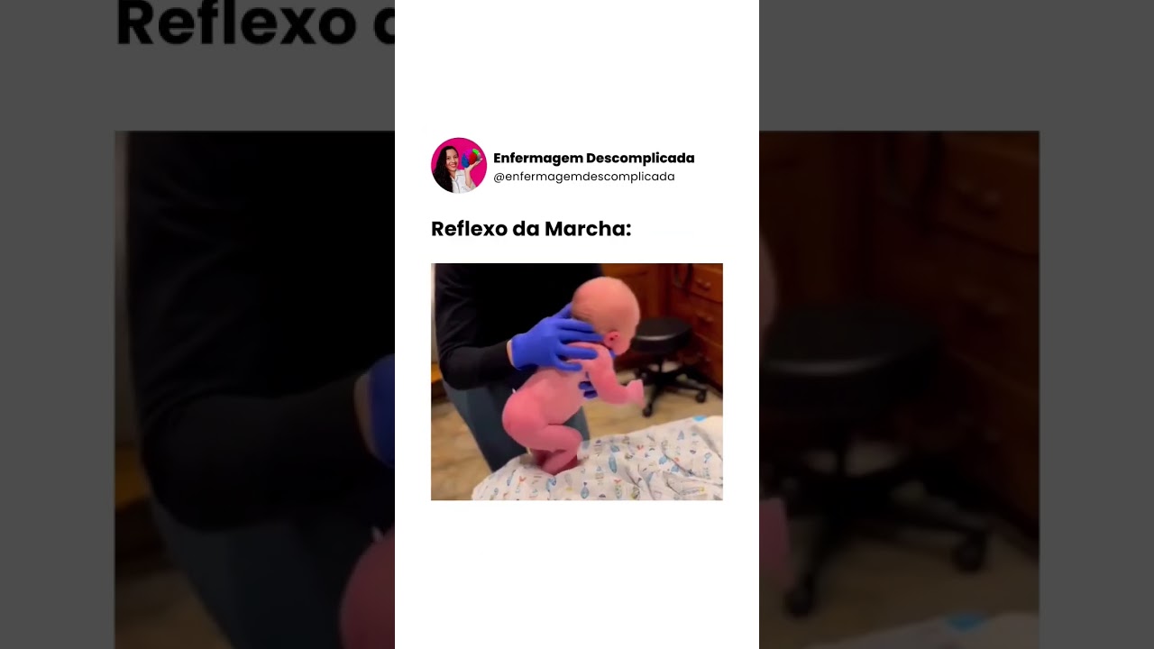 Reflexos do Rec&eacute;m-nascido 🤩 #pediatria #enfermagem