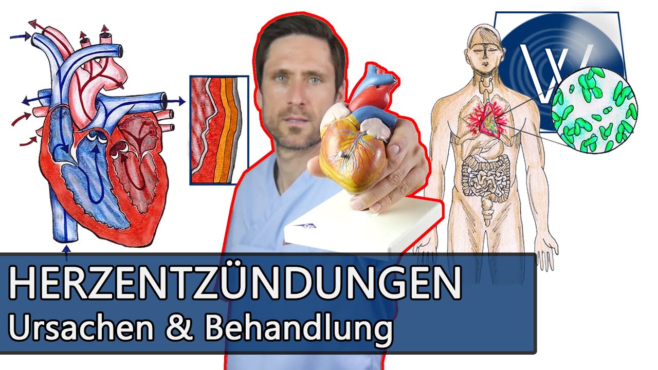 Lebensgefahr Herzmuskelentzündung: Wenn durch Viren, Stress und Erkältung das Herz beschädigt wird