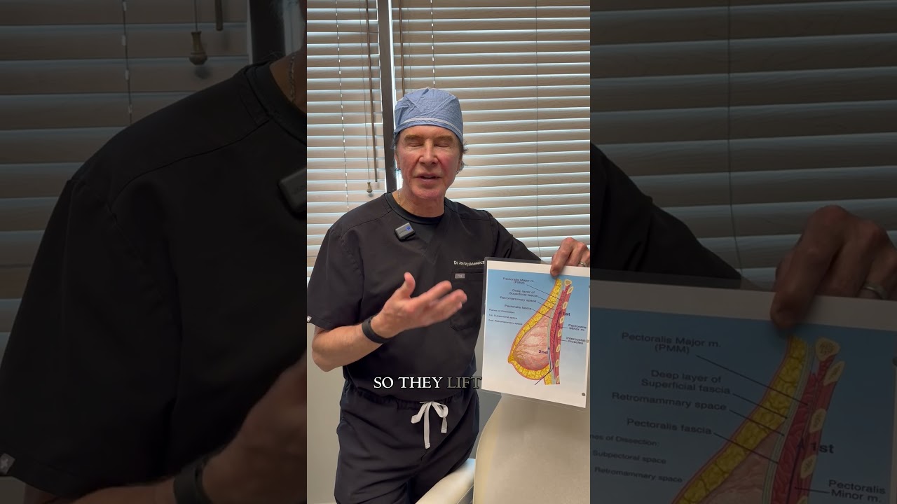 Introducing Dual Plane Breast Augmentation #breastaug #boobjob