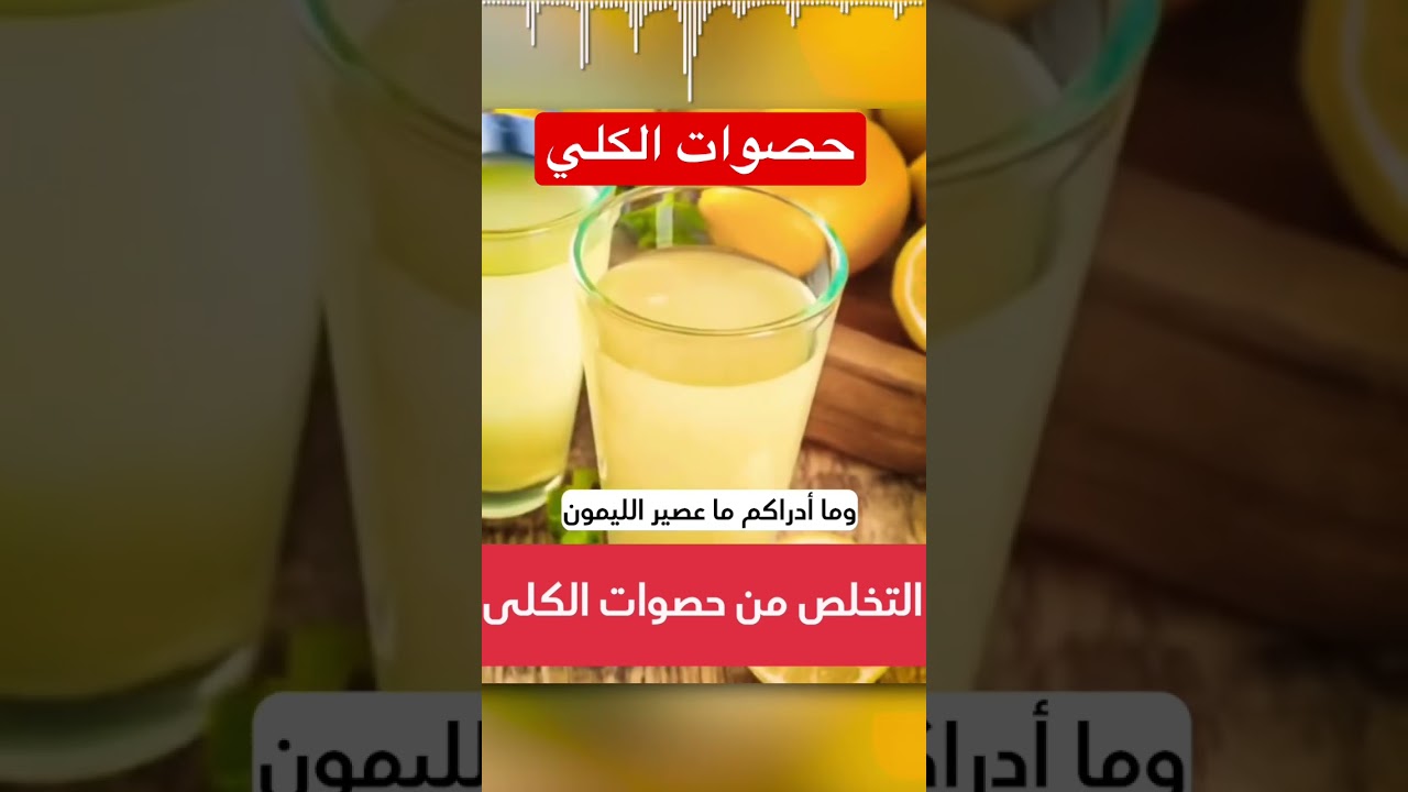 حصوات الكلى فى دقيقة #دكريم_على #فكر_تانى #shorts