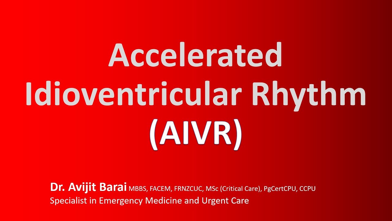 7 things you did not know about the Accelerated Idioventricular Rhythm (AIVR) vs VT