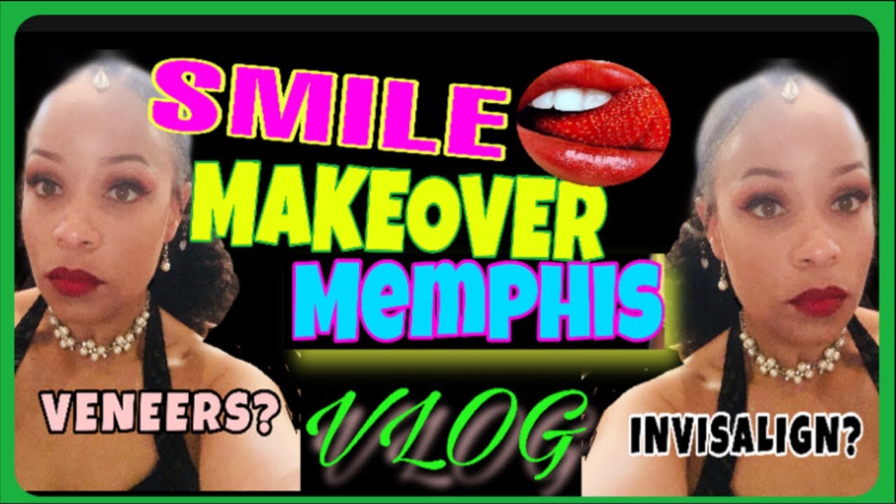 Composite Veneers | Smile Makeover Vlog | #Memphis Dentist DR. Smiles