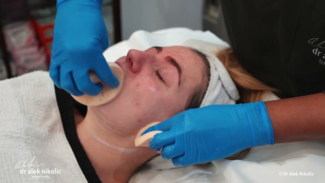 Precision Skincare: Katinka's Journey Begins with VISIA + Dermapen
