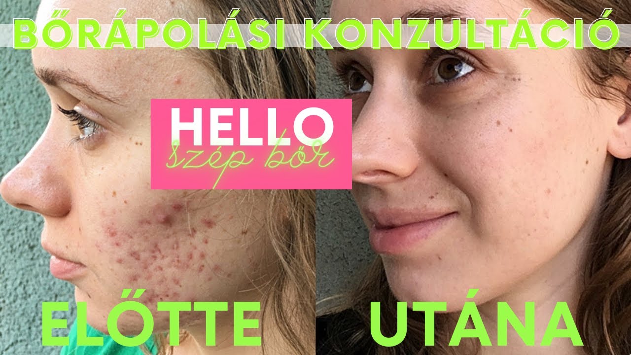 Bőrápolási Konzultáció Q&A - Ildi válaszol a leggyakoribb kérdésekre