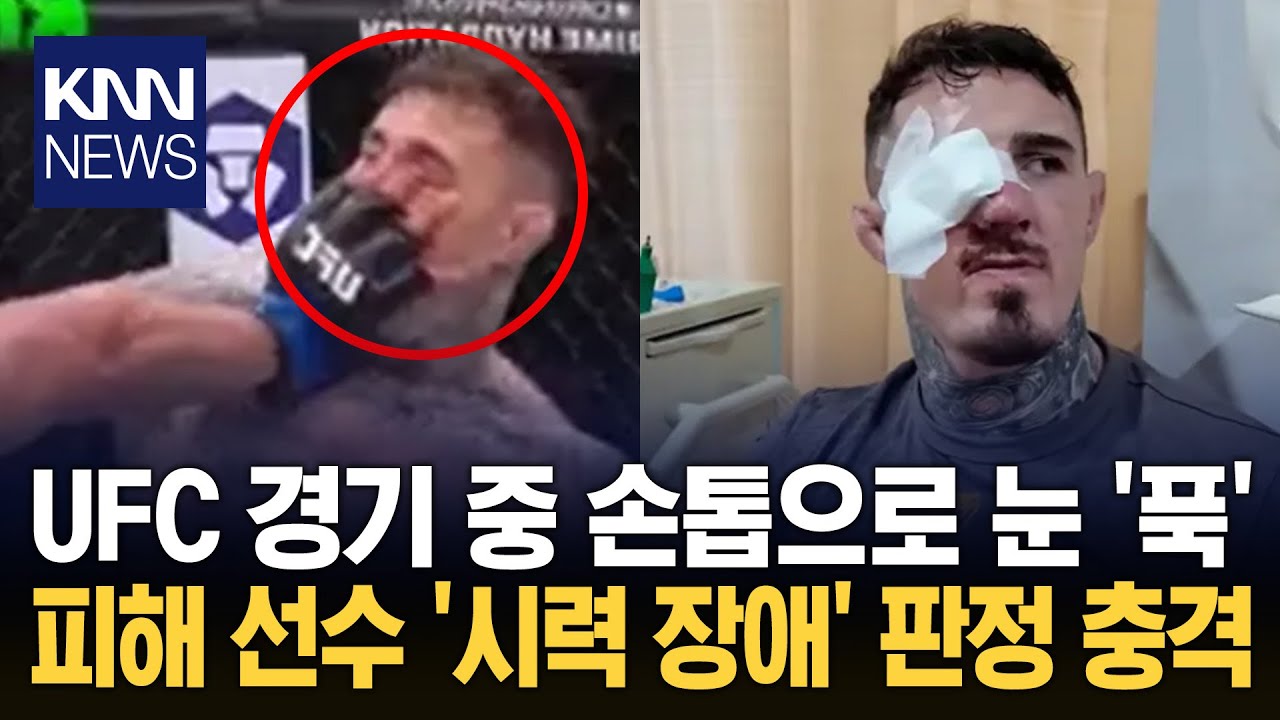 반칙에 눈 찔린 UFC 챔피언 희귀질환 발병에 복귀 '불투명' / KNN