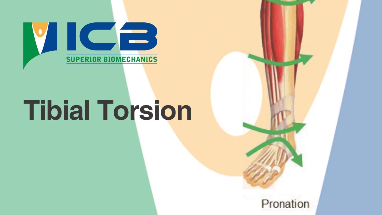 Tibial Torsion Gait Plates