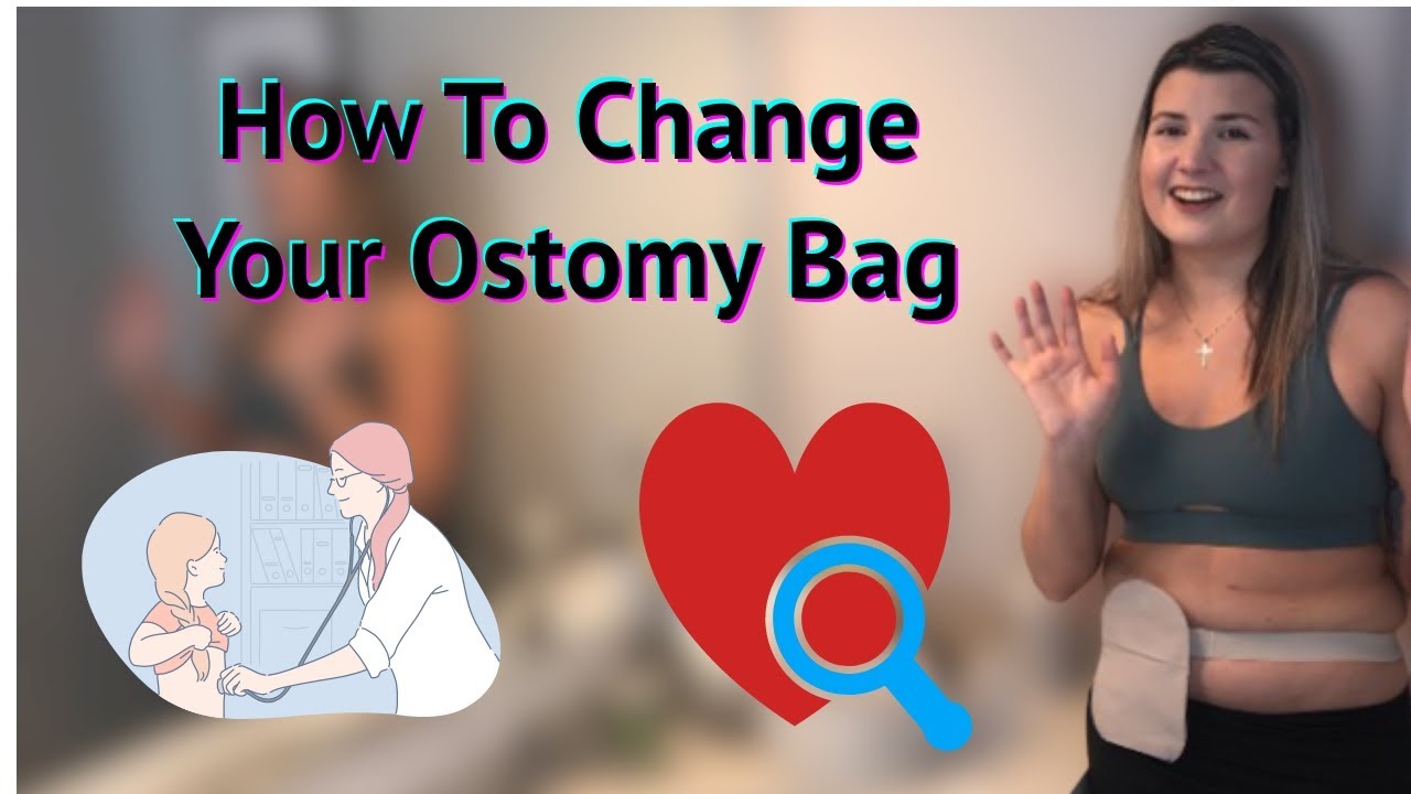 Change My Ostomy Bag With Me // Chronically Me T