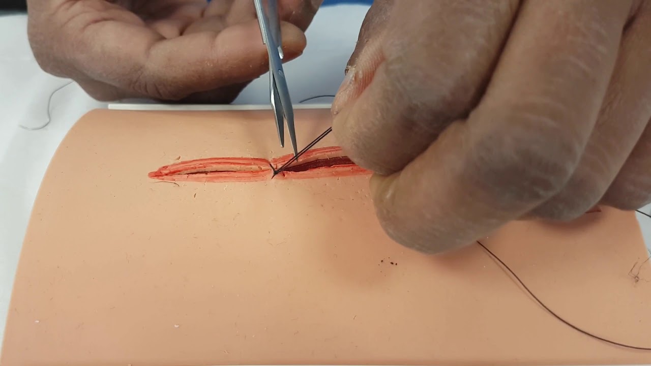 Suturing Skills: Simple Interrupted Suture