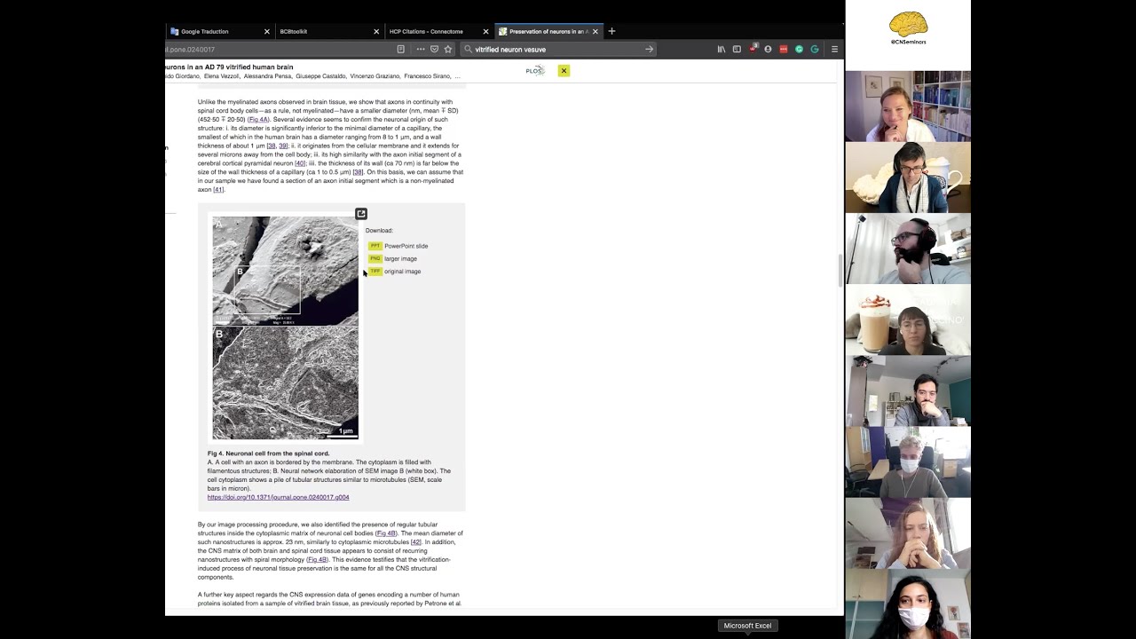 Neuroccino 12th October 2020 - Iron, Pompeii, ageing & algorithms