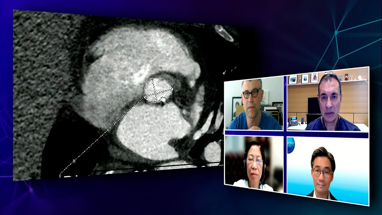 TAVI for today and tomorrow - What matters the most to patients? -  Webinar