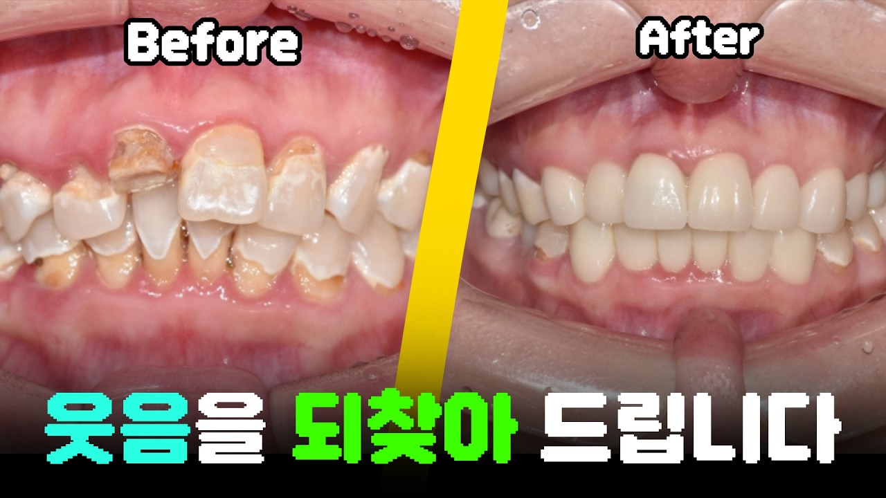 웃음을 되찾아 드립니다.