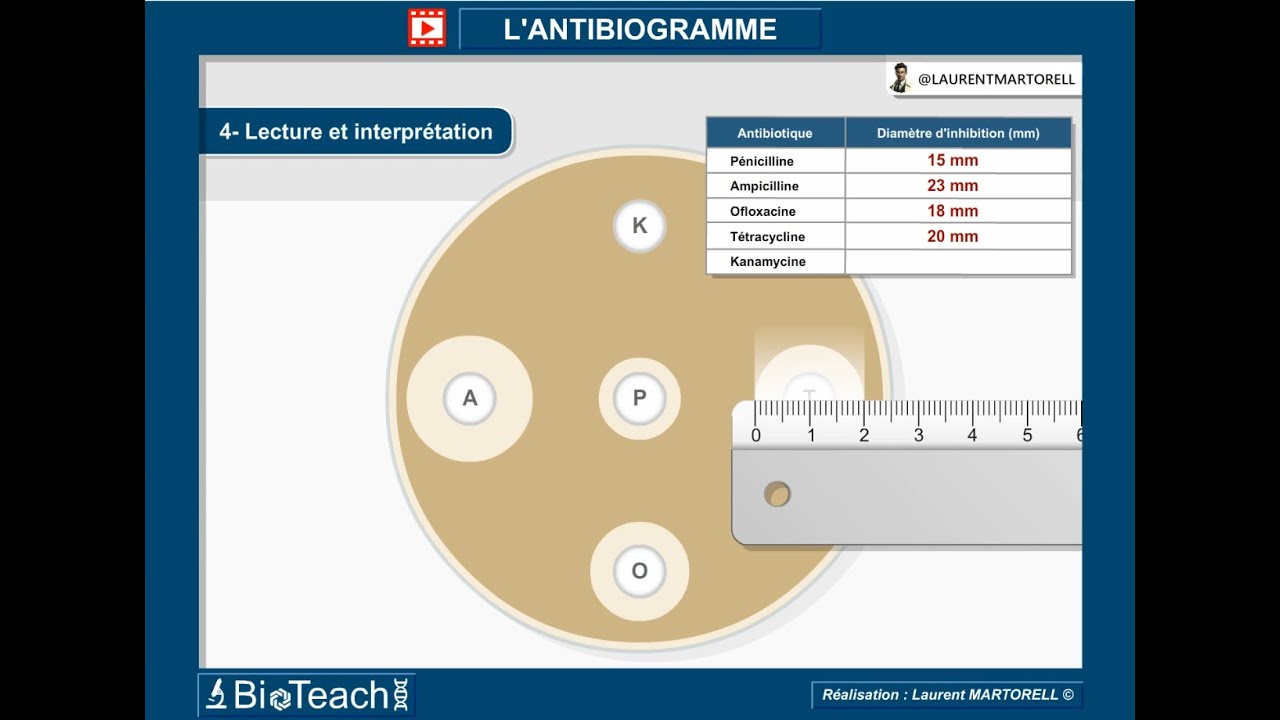 ✅ Tout savoir et comprendre sur l'antibiogramme! → Version courte←