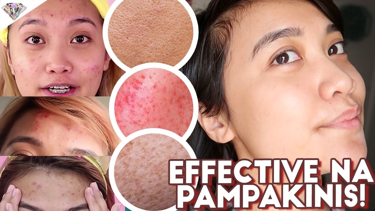 MGA EFFECTIVE NA PAMPAWALA NG TIGYAWAT AT DARK SPOTS | HOW TO ACHIEVE GLOWY SKIN | COLLAGEN UPDATE