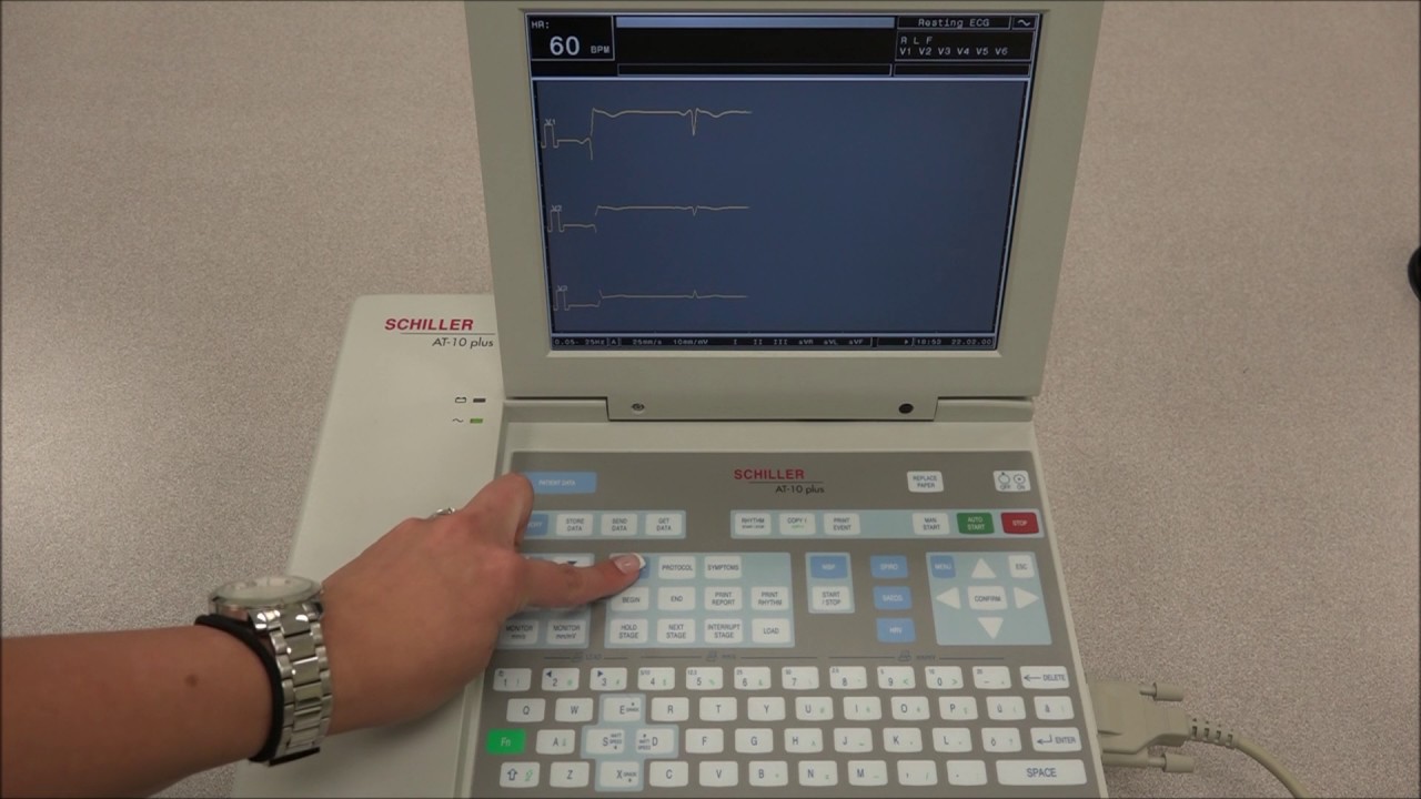 Schiller Cardiovit AT- 10 Plus Basic Functions