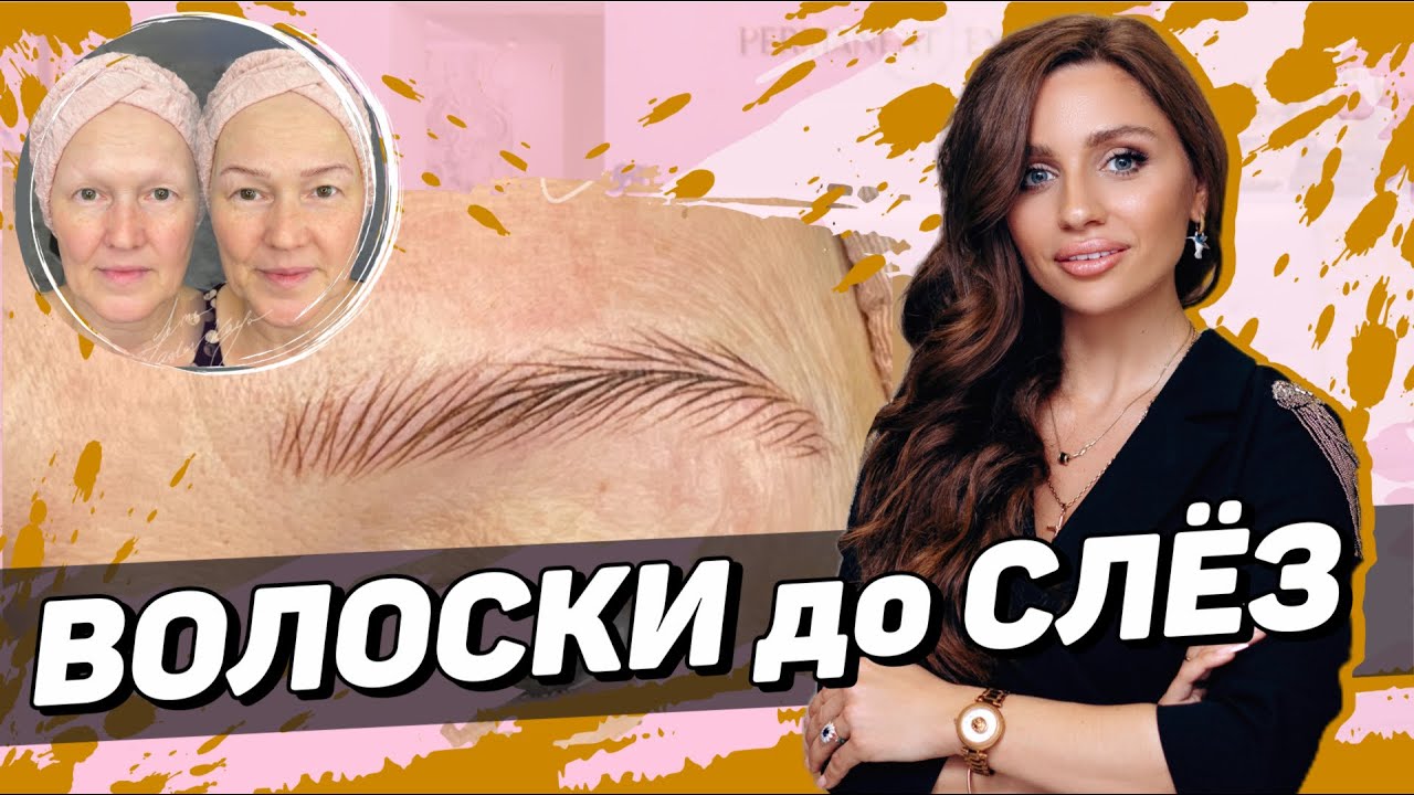 Волосковая техника при алопеции –ПРОЦЕСС ОТ НАЧАЛА И ДО КОНЦА. Мастер класс для мастеров пм