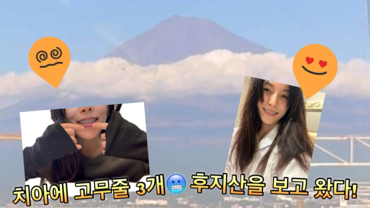 후지산을 보았어요! 암환자는 여행자 보험도 어렵더라구요?😳 40대 치아 교정