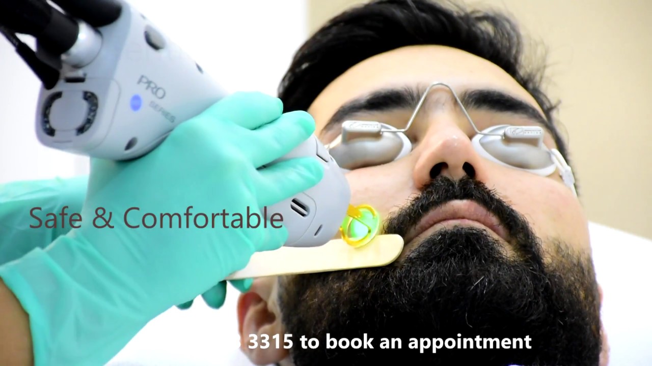 Laser Hair Removal Dubai - Beard Shaping for Men at Confident Dental & Skin Care Clinic