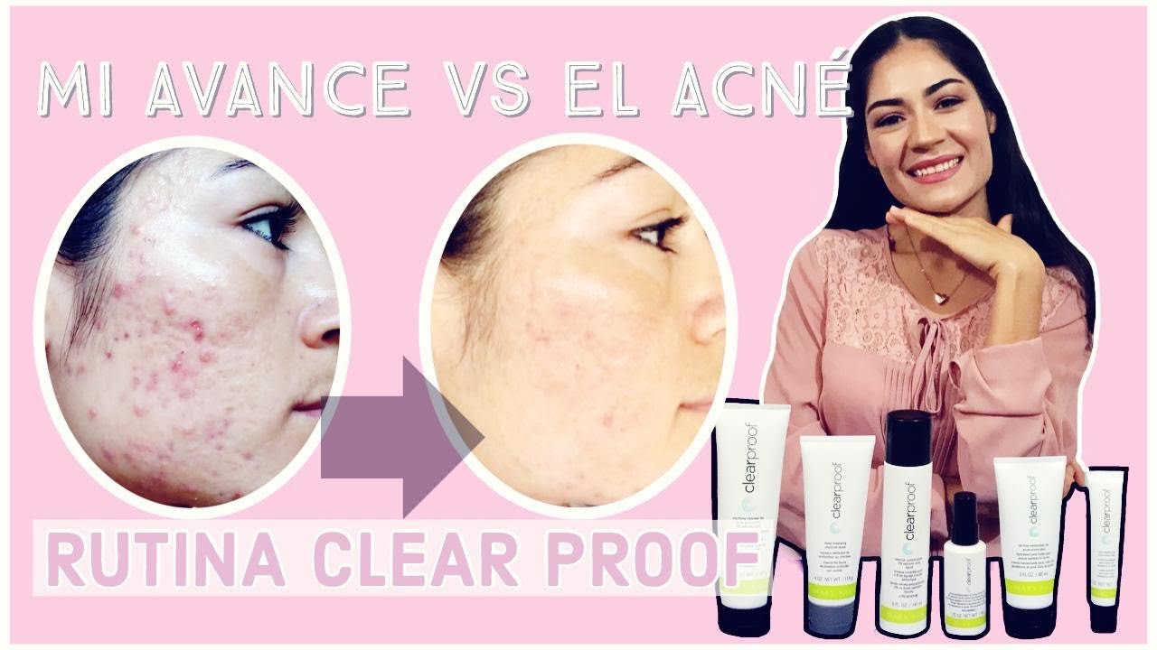 Rutina del cuidado de la piel con tendencia al acné|ClearProof