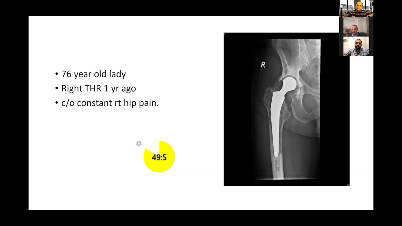 Periprosthetic joint infection -  viva practice for the FRCS Trauma and Orthopaedics exam