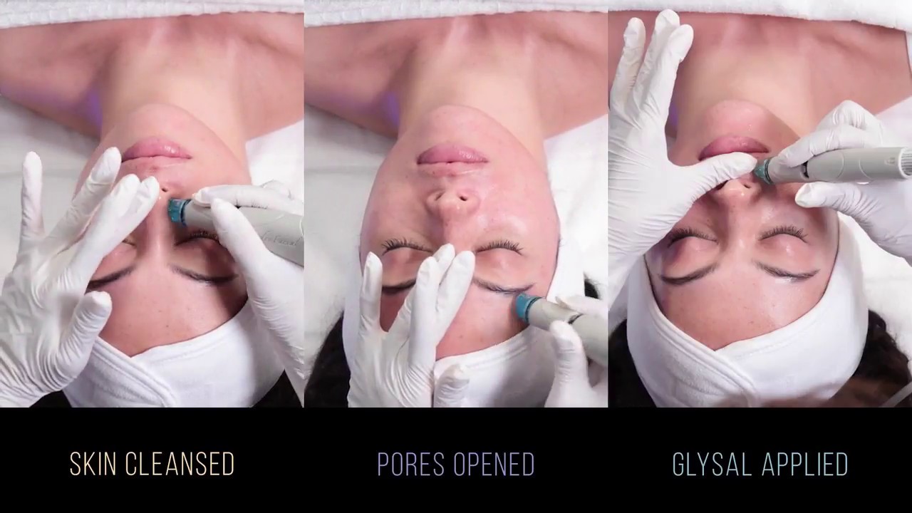 HydraFacial Signature behandeling - TRAINING