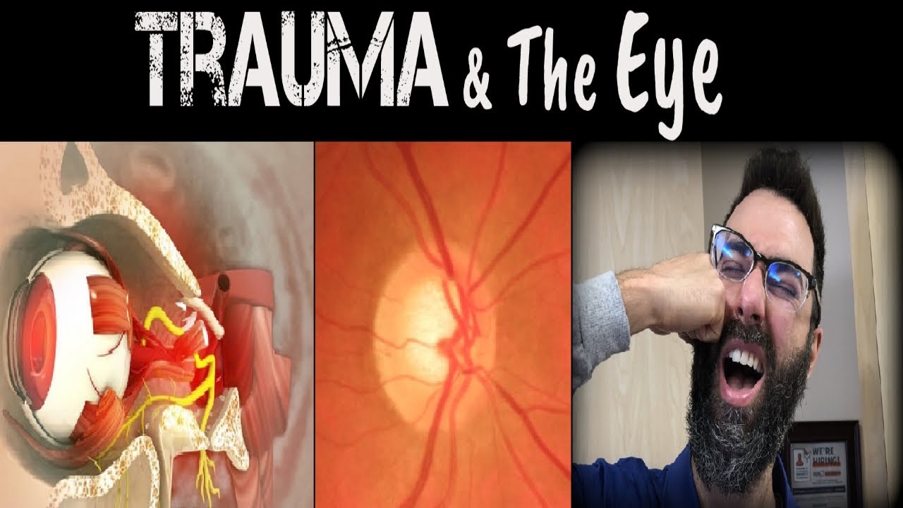 How Trauma Affects The Eye | Traumatic Optic Neuropathy | Signs, Symptoms, Diagnosis, Treatment