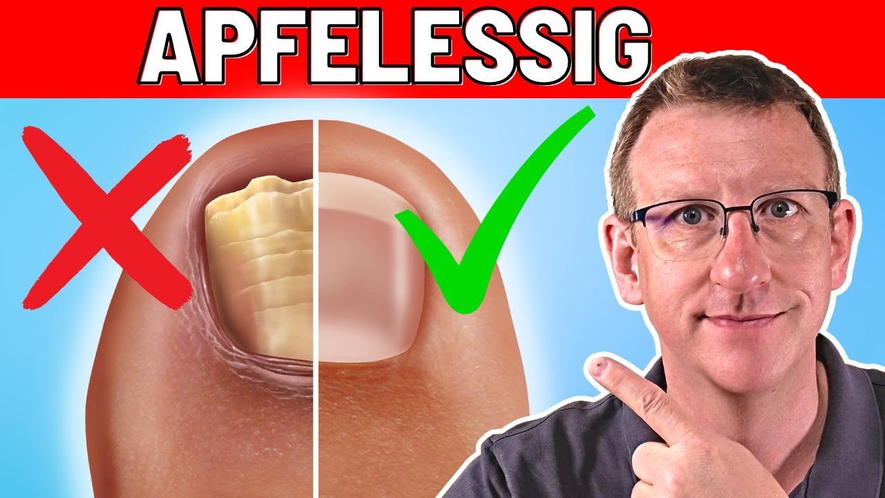 Apfelessig - 3 erstaunliche Vorteile für Haut & Haare!