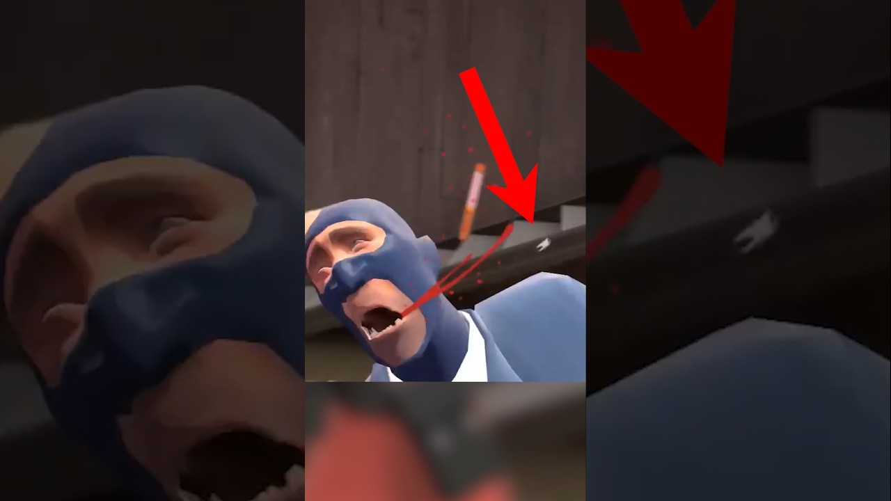 The Spy is missing a tooth.  #tf2