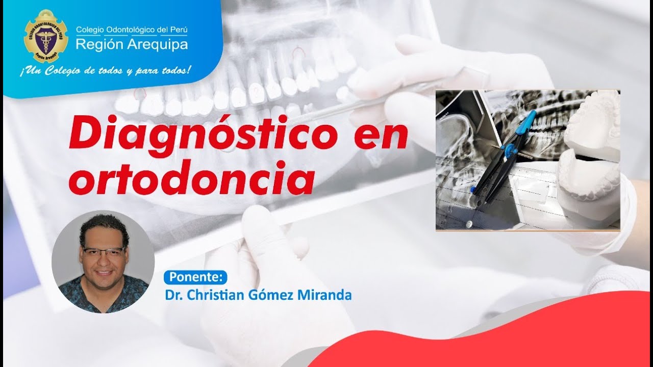 CONFERENCIA GRATUITA DIAGNÓSTICO EN ORTODONCIA
